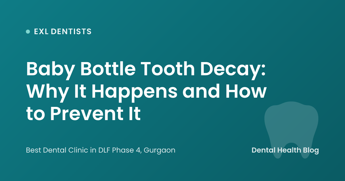 Baby Bottle Tooth Decay: Why It Happens and How to Prevent It