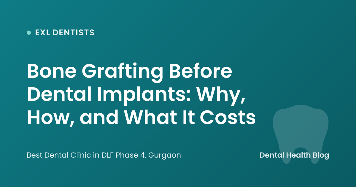 Bone Grafting Before Dental Implants: Why, How, and What It Costs