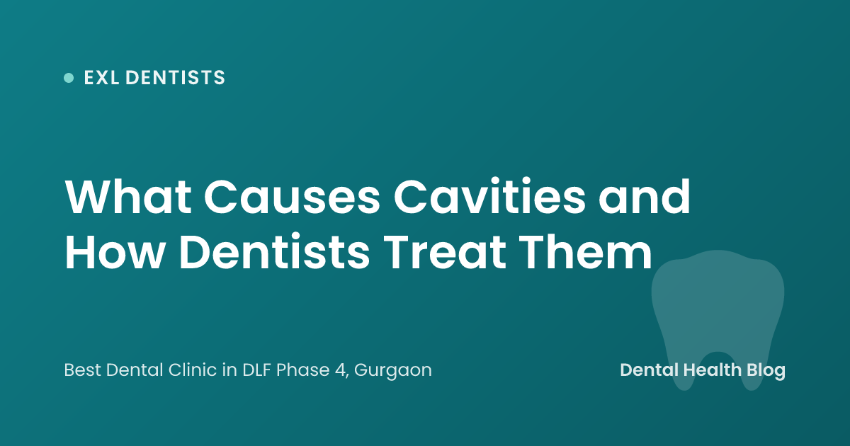 What Causes Cavities and How Dentists Treat Them