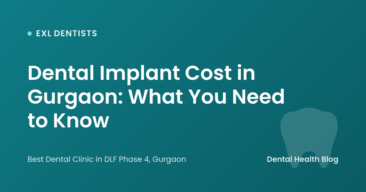 Dental Implant Cost in Gurgaon: What You Need to Know