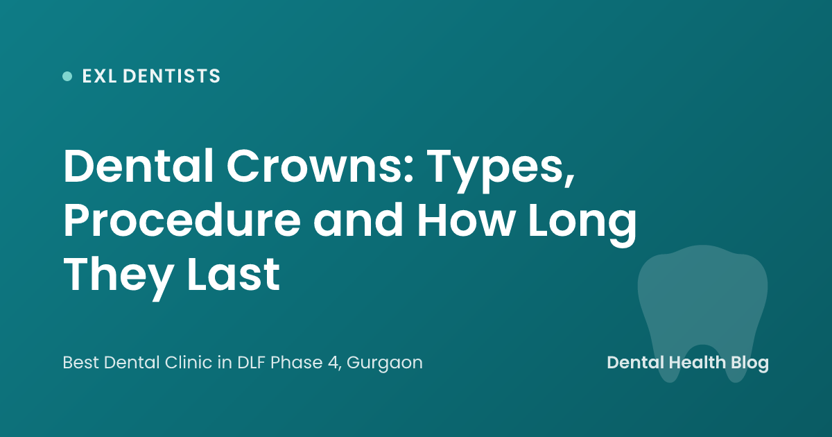 Dental Crowns: Types, Procedure and How Long They Last