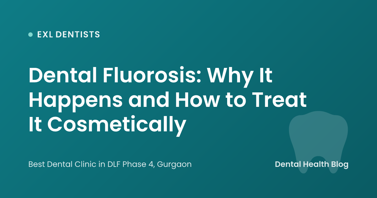 Dental Fluorosis: Why It Happens and How to Treat It Cosmetically