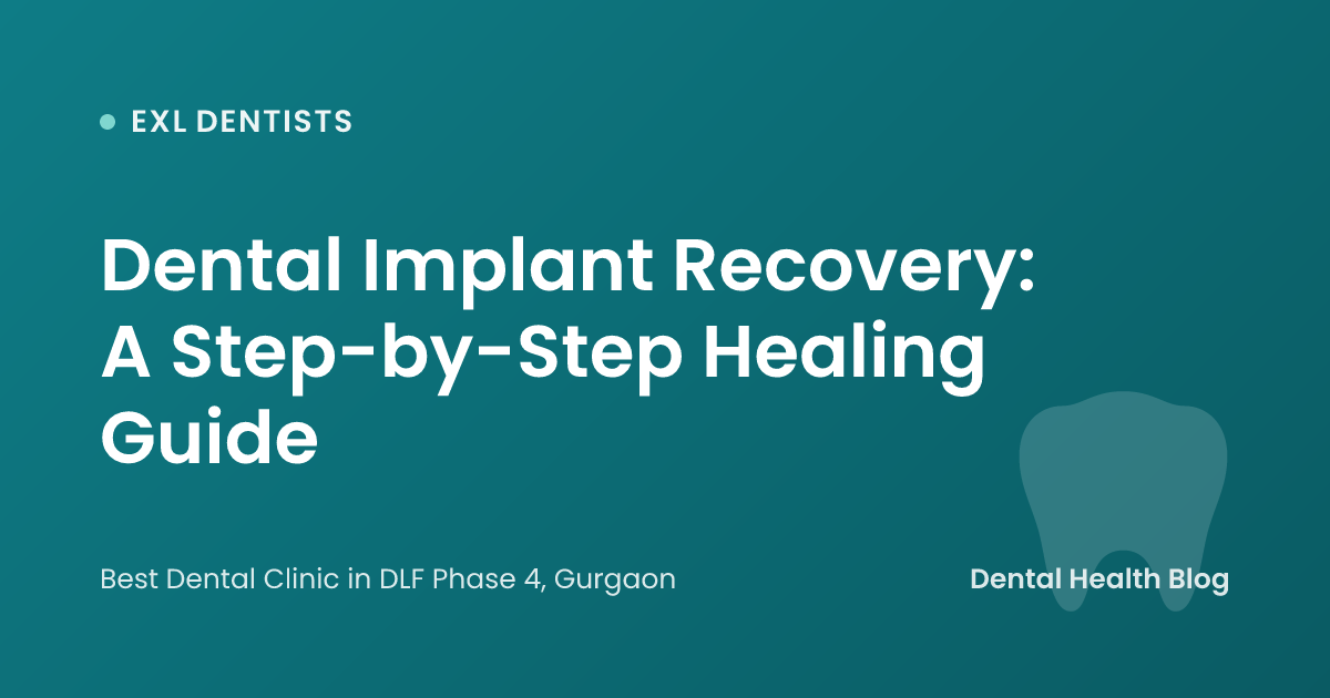 Dental Implant Recovery: A Step-by-Step Healing Guide