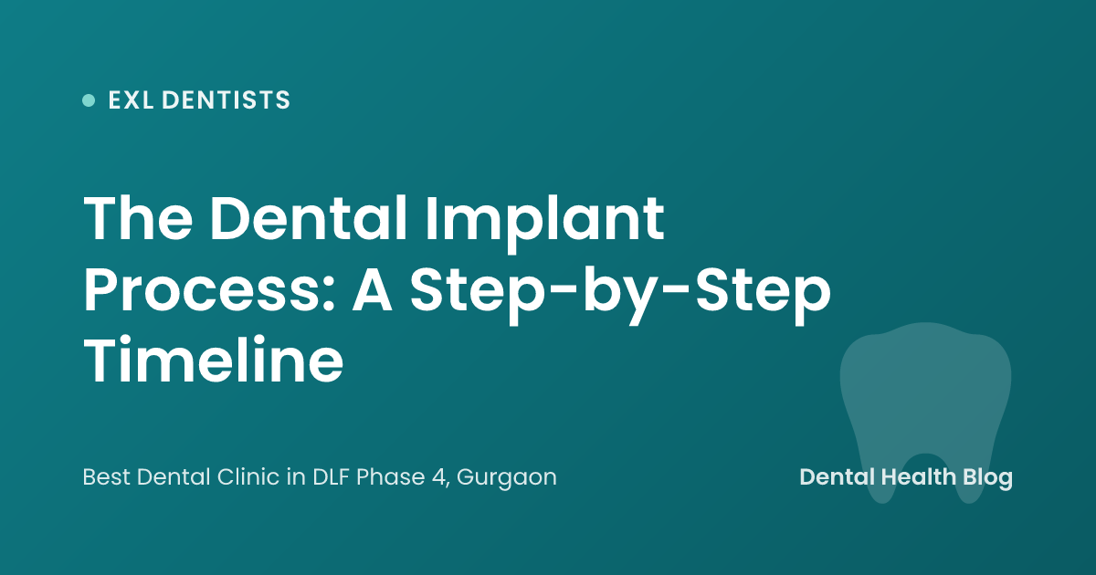 The Dental Implant Process: A Step-by-Step Timeline