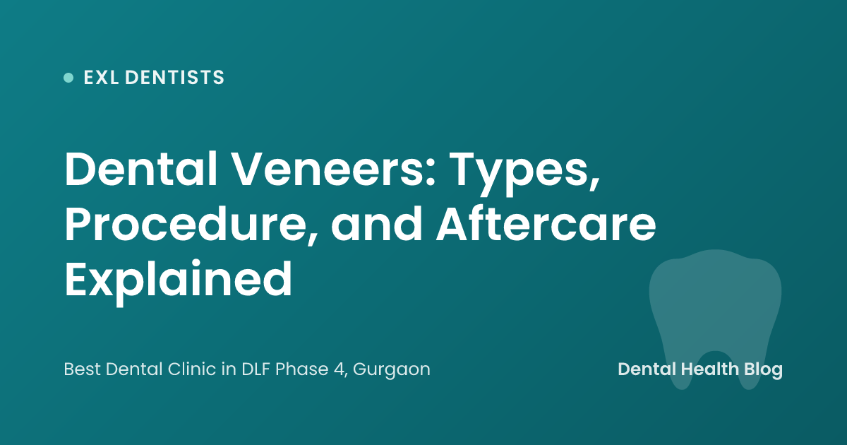 Dental Veneers: Types, Procedure, and Aftercare Explained