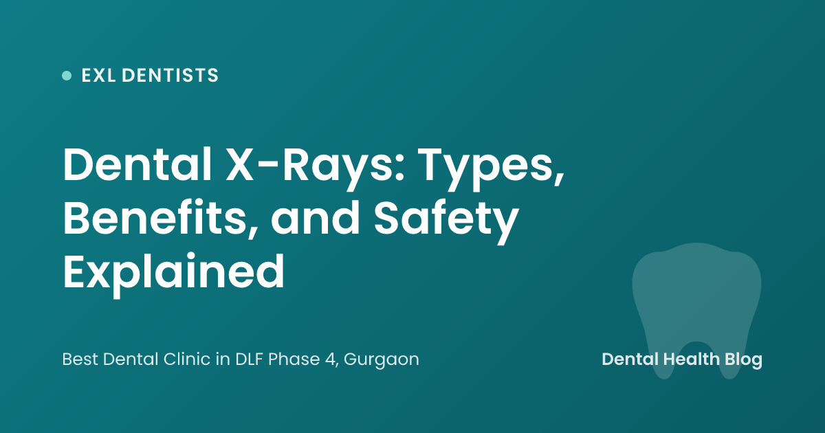 Dental X-Rays: Types, Benefits, and Safety Explained