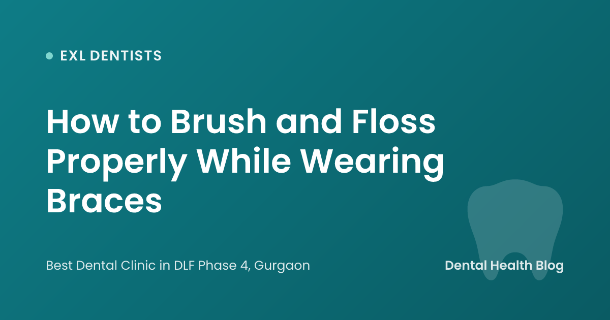 How to Brush and Floss Properly While Wearing Braces