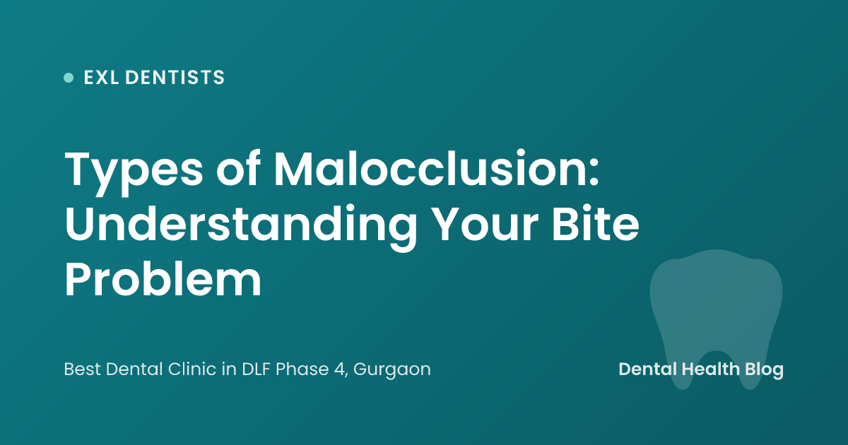 Types of Malocclusion: Understanding Your Bite Problem