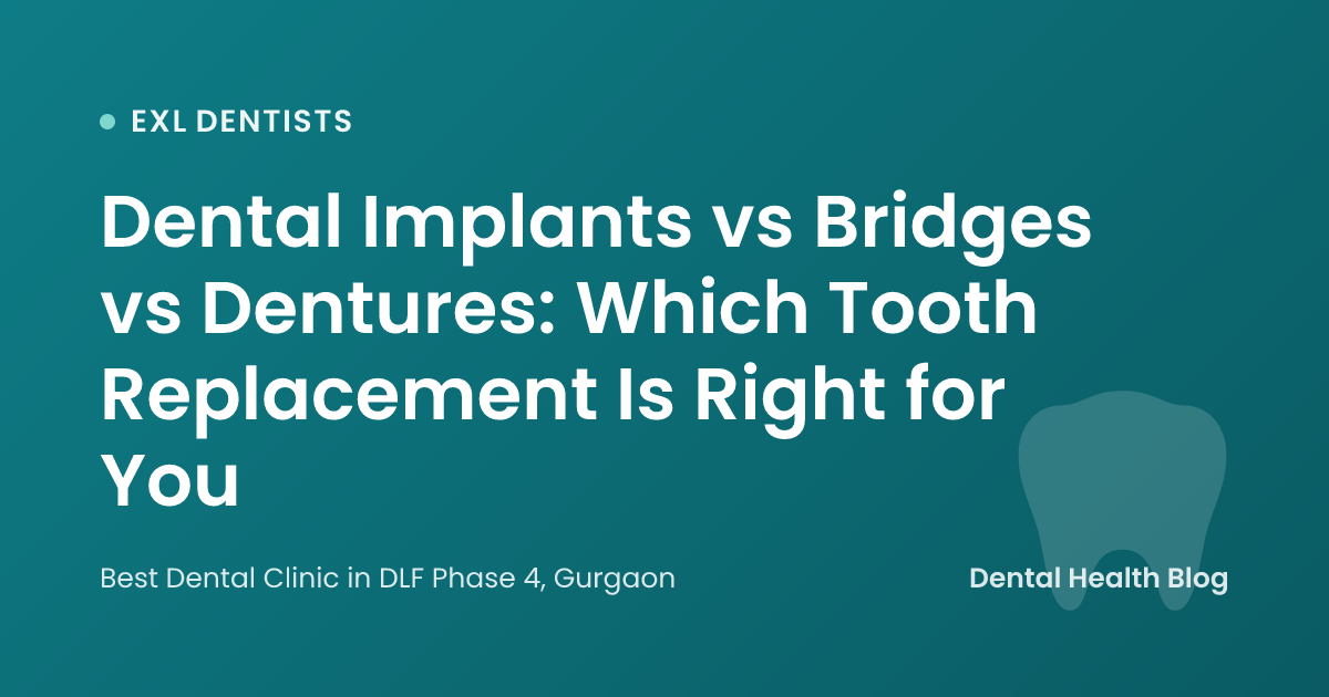 Dental Implants vs Bridges vs Dentures: Which Tooth Replacement Is Right for You