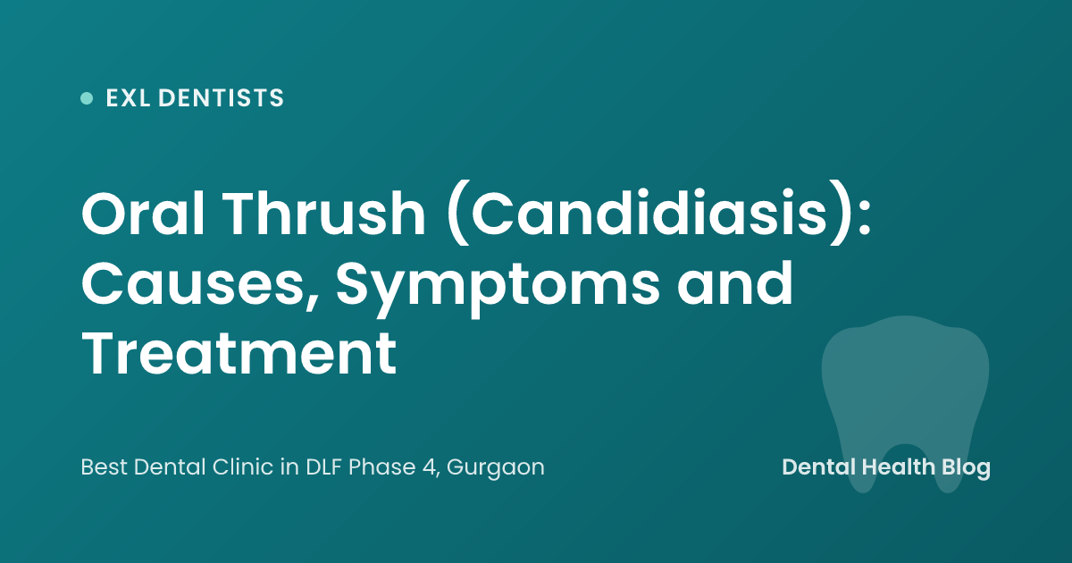 Oral Thrush (Candidiasis): Causes, Symptoms and Treatment