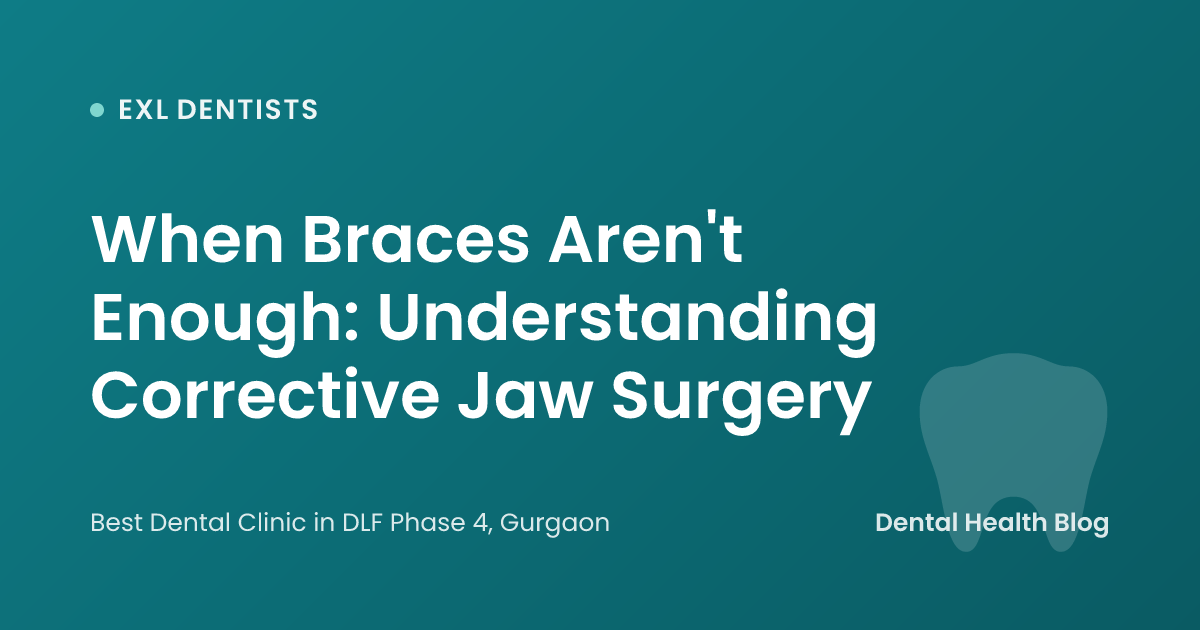 When Braces Aren't Enough: Understanding Corrective Jaw Surgery