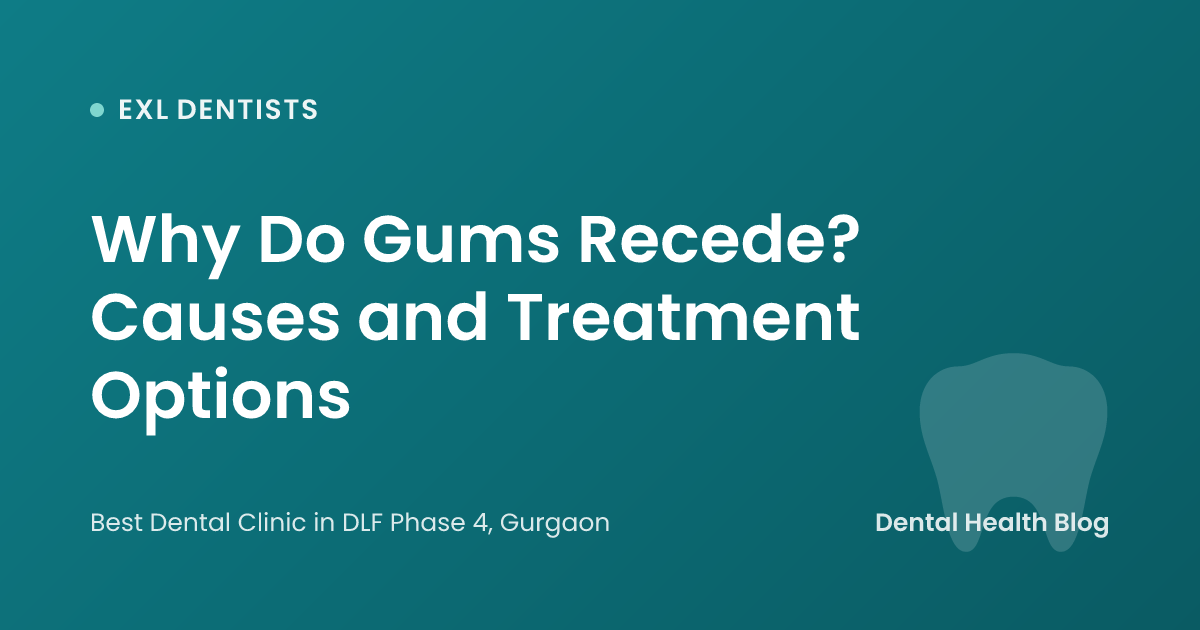 Why Do Gums Recede? Causes and Treatment Options