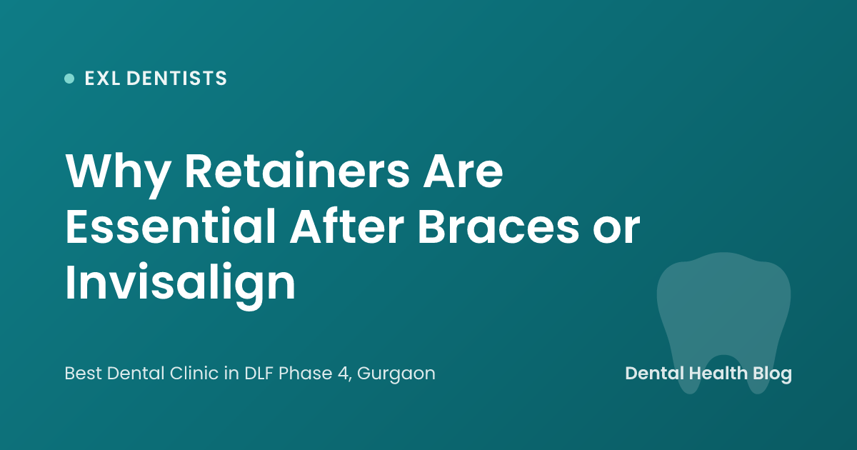 Why Retainers Are Essential After Braces or Invisalign