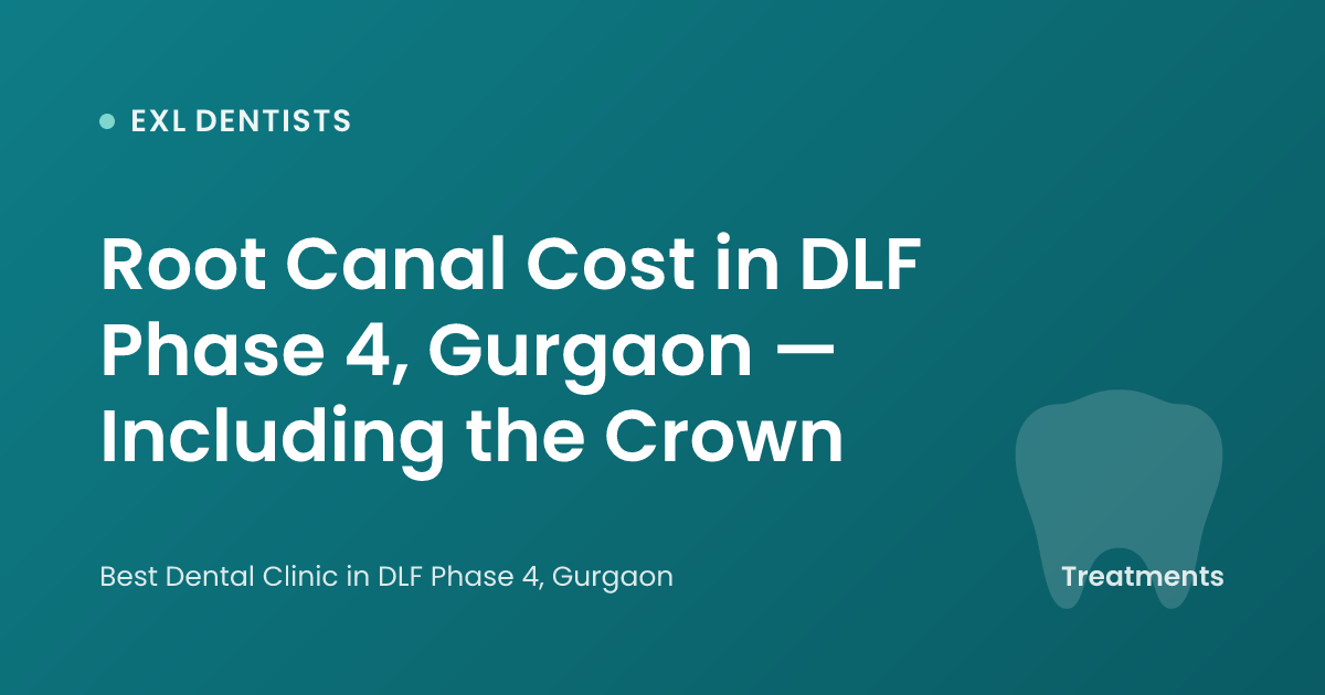 Root Canal Cost in DLF Phase 4, Gurgaon — Including the Crown