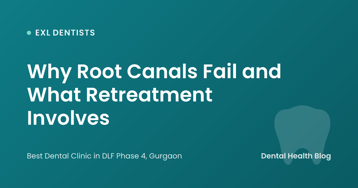 Why Root Canals Fail and What Retreatment Involves