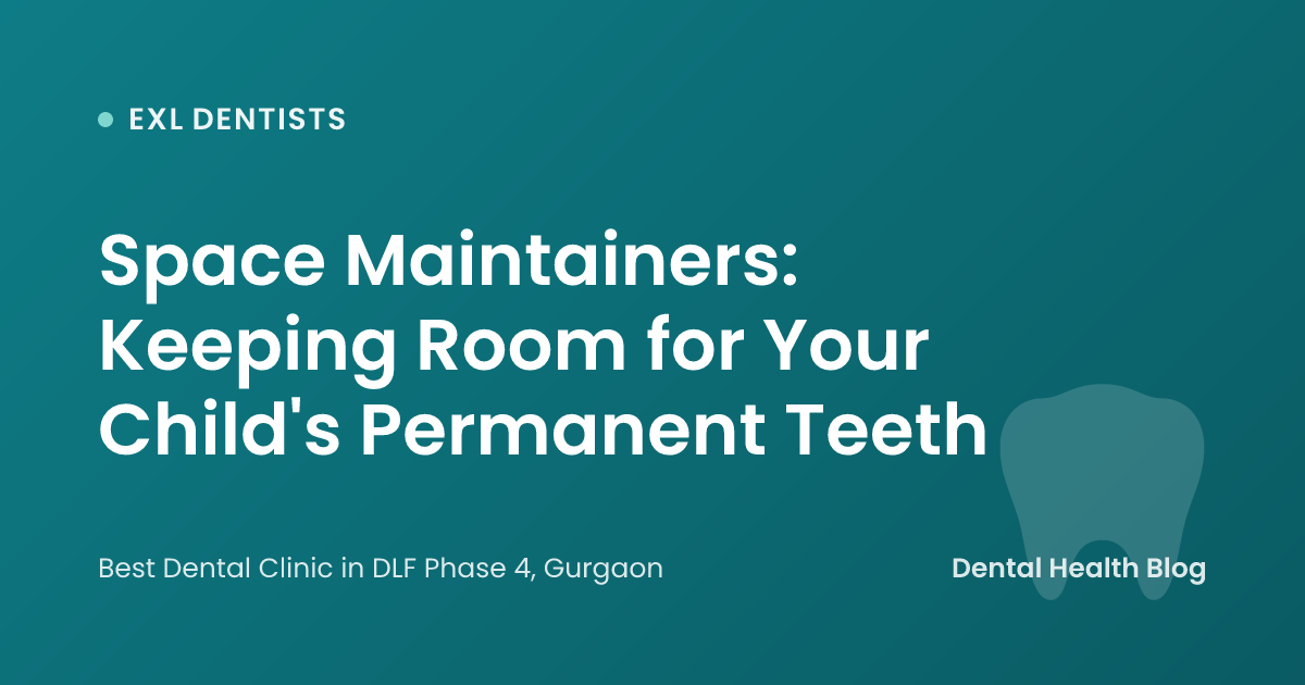 Space Maintainers: Keeping Room for Your Child's Permanent Teeth
