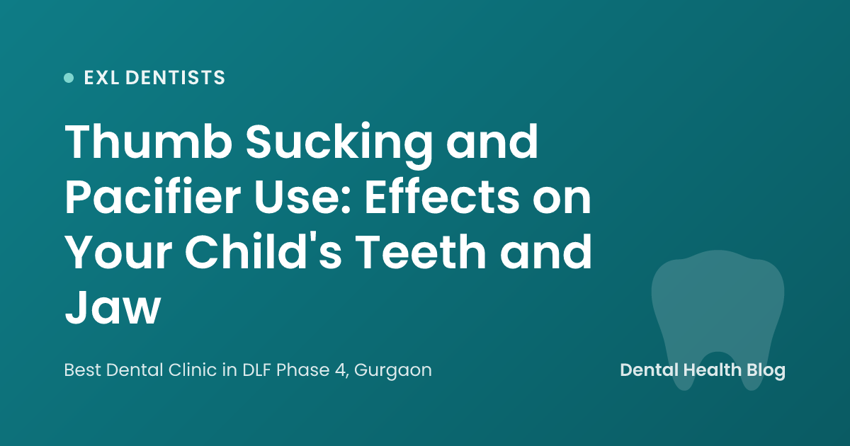 Thumb Sucking and Pacifier Use: Effects on Your Child's Teeth and Jaw