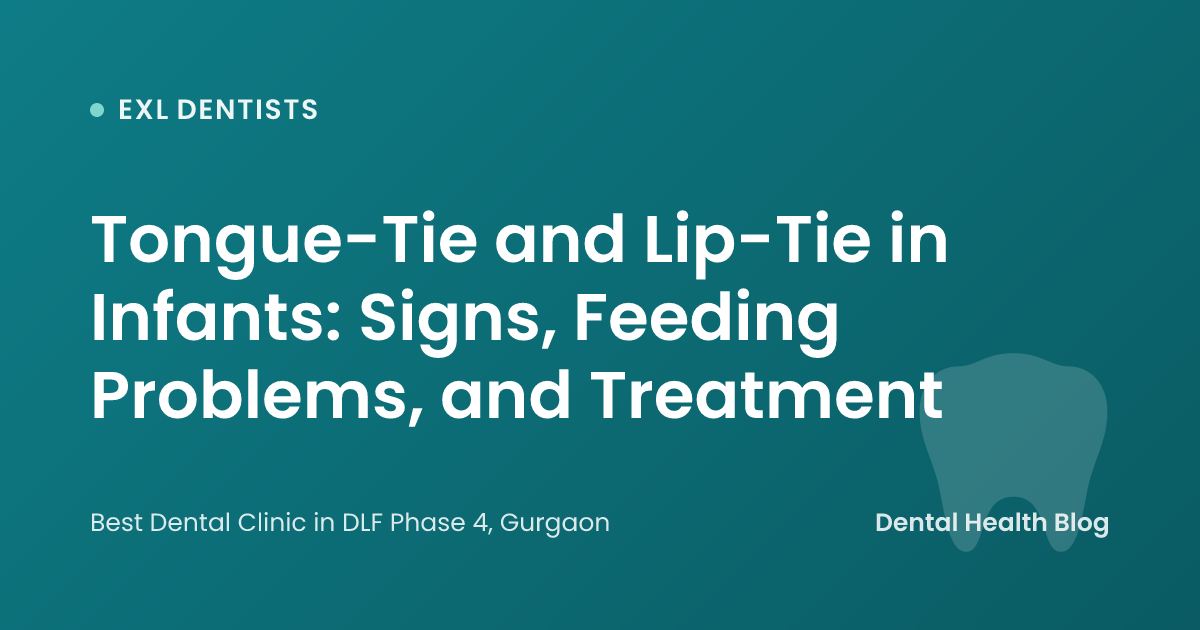 Tongue-Tie and Lip-Tie in Infants: Signs, Feeding Problems, and Treatment