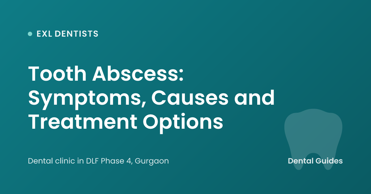 Tooth Abscess: Symptoms, Causes and Treatment Options