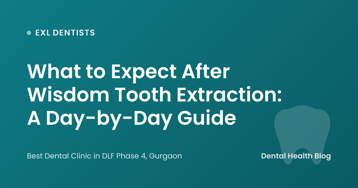 What to Expect After Wisdom Tooth Extraction: A Day-by-Day Guide