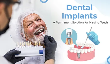 dental implants