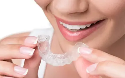 invisible aligners in gurgaon Invisalign Treatment