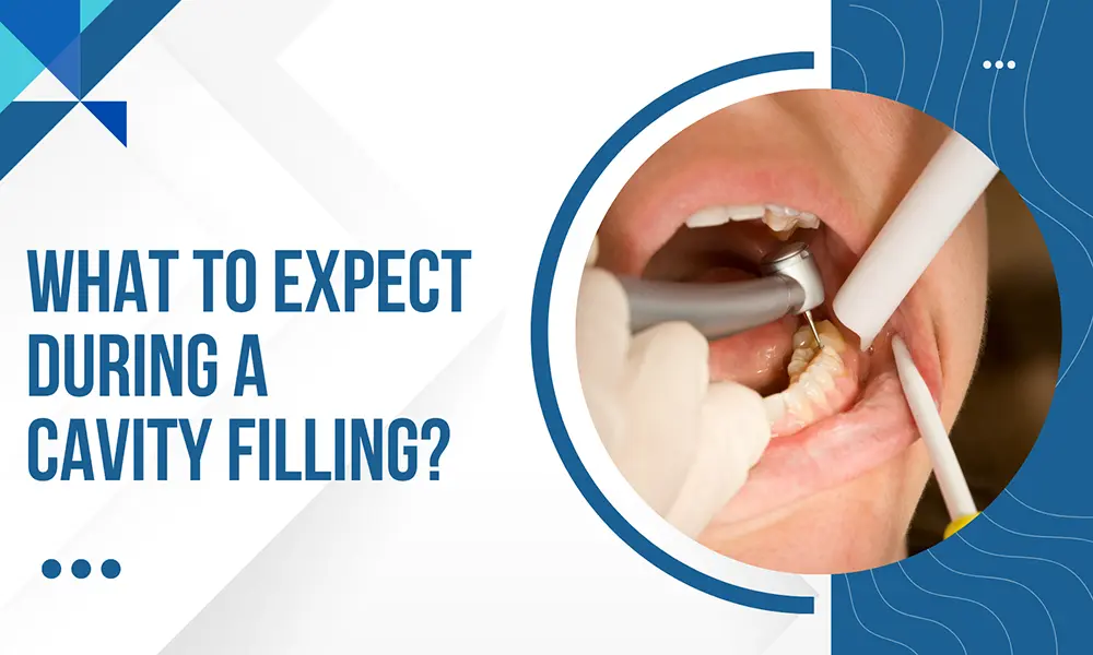 WHAT TO EXPECT DURING A CAVITY FILLING?