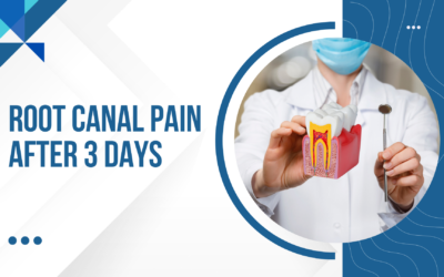 Blogs 5 Root Canal Pain After 3 Days