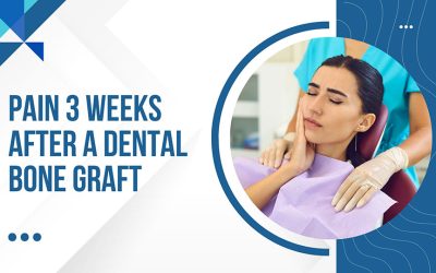 Blogs 4 Pain 3 Weeks After a Dental Bone Graft