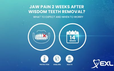 Blogs 10 Jaw Pain 2 Weeks After Wisdom Teeth Removal?