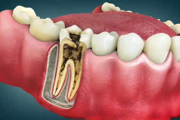 general dentistry in dlf phase 1 general-dentistry