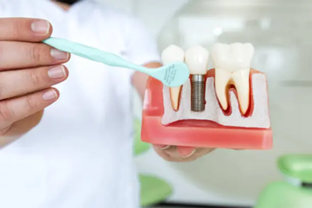 gum treatment in dlf phase 1 gum-treatment