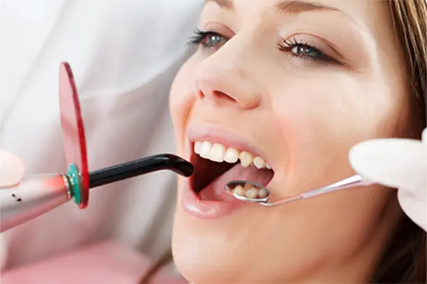 root canal treatment in dlf phase 1 root-canal-treatment