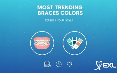 Blogs 6 Most Trending Braces Color