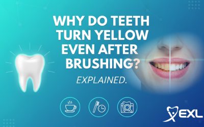 Blogs 7 Why Do Teeth Turn Yellow Even After Brushing?