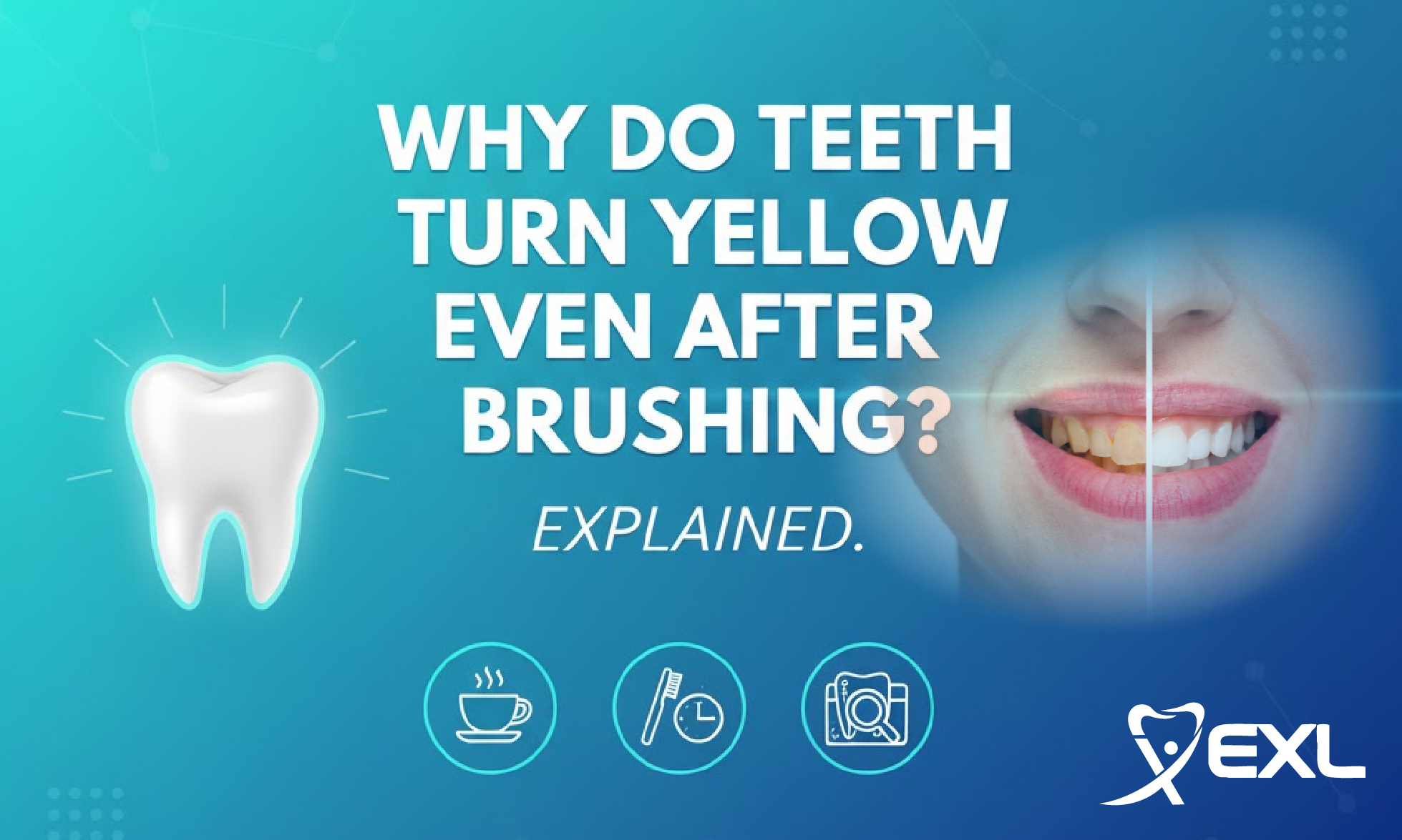 Why Teeth Turn Yellow Even After Brushing Gurgaon Dental Care