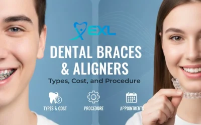 Home 15 Dental Braces and Aligners: Types, Cost, and Procedure