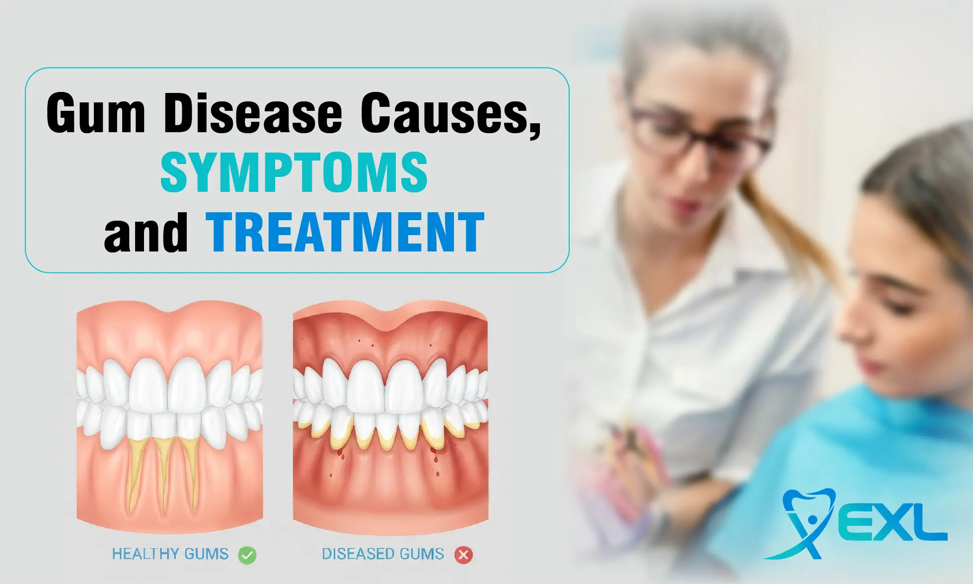 Gum Disease Causes, Symptoms, and Treatment