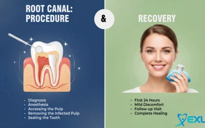 Home 13 Root Canal: Procedure & Recovery