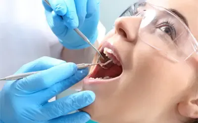 Smile Makeover