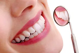 Teeth whitening