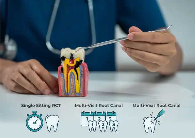 Different Types of Root Canal Treatments We Offer