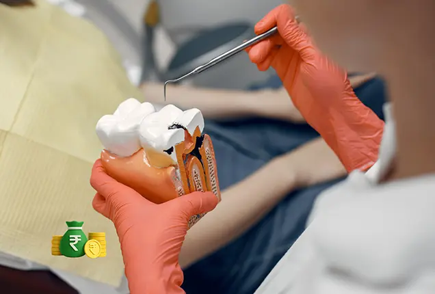 Root Canal Treatment Cost in Gurgaon