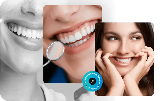 Smile makeover treatments in Gurgaon