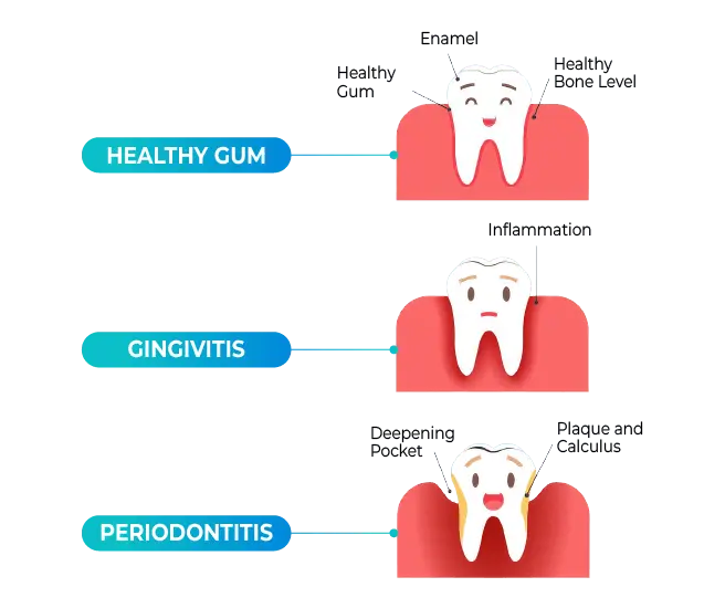 General Dentistry for Your Healthy Smile