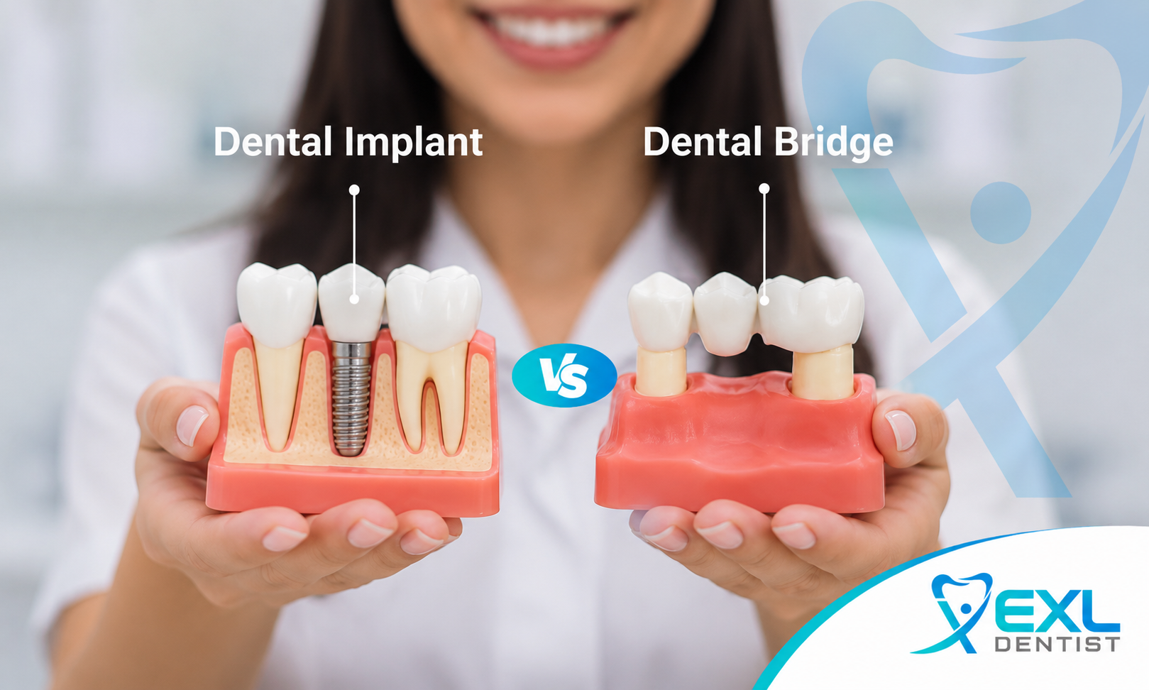 Dental Implant vs Dental Bridge